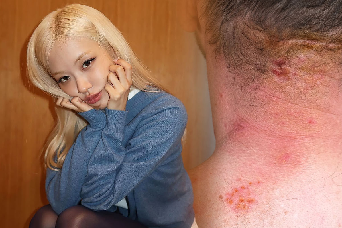 출처: 로제 인스타그램/셔터스톡